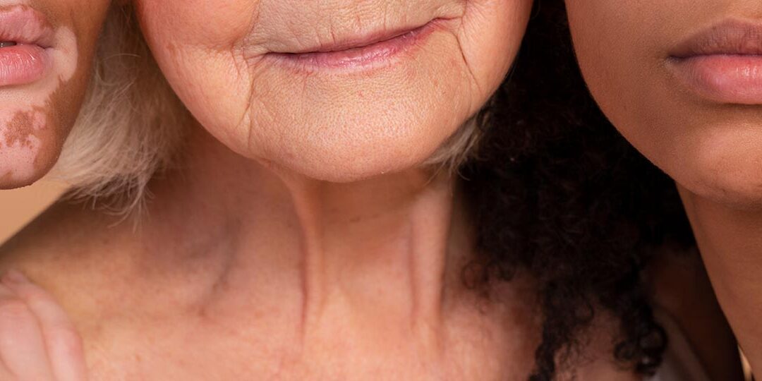 Rutinas de la piel según el tipo: grasa, seca, mixta o sensible