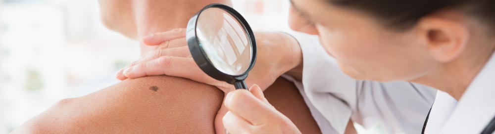 dermatologo manchas en la cara. Cuidados piel